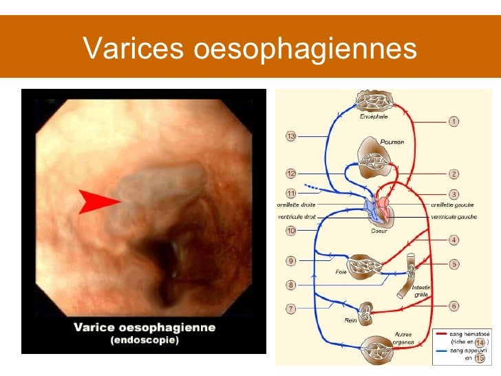 Cours 4 Pathologie vasculaire