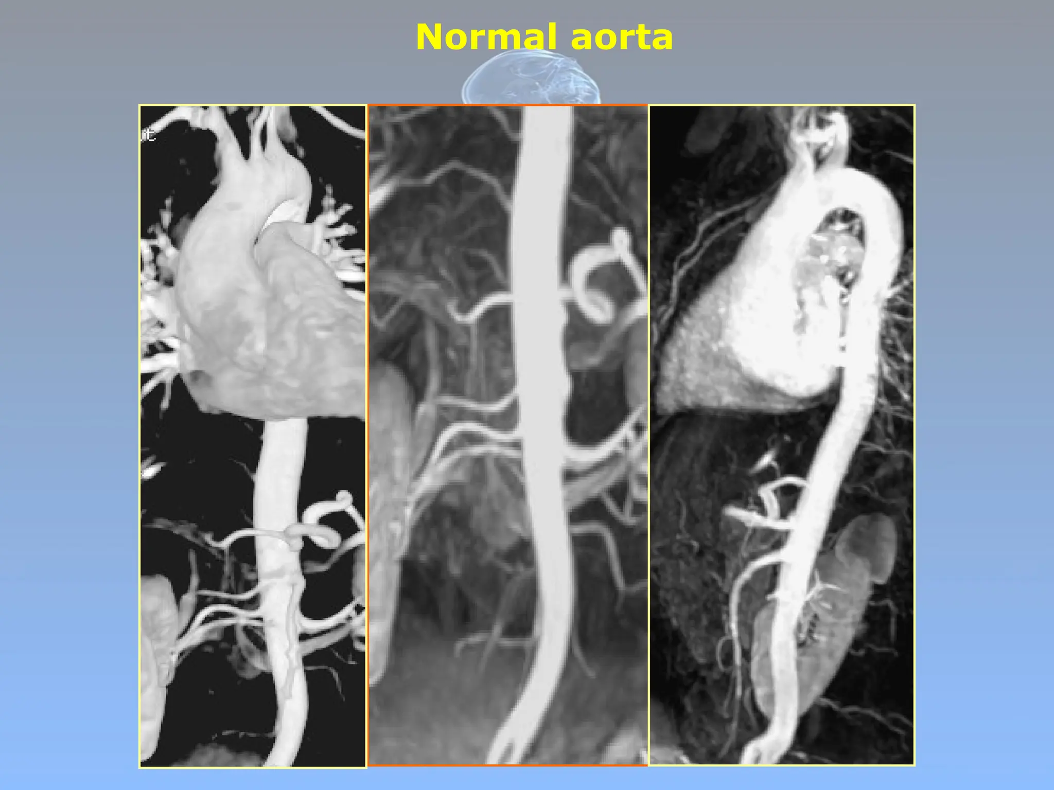 Vascular radiology blood vessels x ray CT MRI .pptx