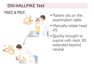 DIX-HALLPIKE Test
• Patient sits on the
examination table
• Manually rotate head
45
• Quickly brought to
supine with neck 30
extended beyond
neutral
*ASCC & PSCC
 