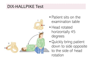 • Patient sits on the
examination table
• Head rotated
horizontally 45
degrees
• Quickly bring patient
down to side opposite
to the side of head
rotation
DIX-HALLPIKE Test
 