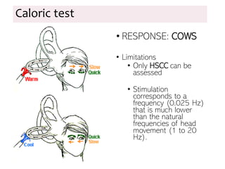 Caloric test
• RESPONSE: COWS
• Limitations
• Only HSCC can be
assessed
• Stimulation
corresponds to a
frequency (0.025 Hz)
that is much lower
than the natural
frequencies of head
movement (1 to 20
Hz).
 