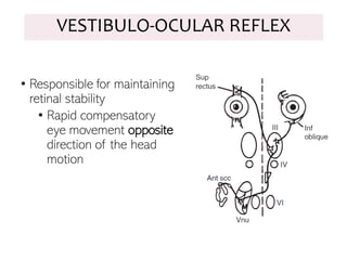 VESTIBULO-OCULAR REFLEX
• Responsible for maintaining
retinal stability
• Rapid compensatory
eye movement opposite
direction of the head
motion
 