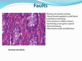 Faults 
Section too thick 
•Wrong micrometer setting 
• Warm breath applied to cold block 
to facilitate sectioning 
• First section in ribbon chosen 
• Sectioning at too great a speed 
• Poor processing 
• Microtome needs recalibration 
 
