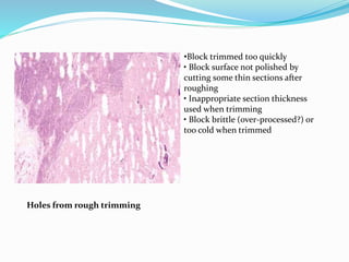 Holes from rough trimming 
•Block trimmed too quickly 
• Block surface not polished by 
cutting some thin sections after 
roughing 
• Inappropriate section thickness 
used when trimming 
• Block brittle (over-processed?) or 
too cold when trimmed 
 