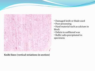 Knife lines (vertical striations in section) 
• Damaged knife or blade used 
• Poor processing 
• Hard material such as calcium in 
block 
• Debris in unfiltered wax 
• Buffer salts precipitated in 
specimens 
 