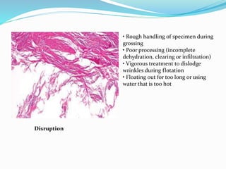 Disruption 
• Rough handling of specimen during 
grossing 
• Poor processing (incomplete 
dehydration, clearing or infiltration) 
• Vigorous treatment to dislodge 
wrinkles during flotation 
• Floating out for too long or using 
water that is too hot 
 