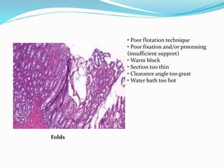 Folds 
• Poor flotation technique 
• Poor fixation and/or processing 
(insufficient support) 
• Warm block 
• Section too thin 
• Clearance angle too great 
• Water bath too hot 
 