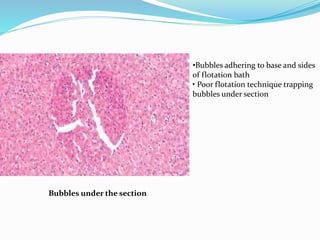 Bubbles under the section 
•Bubbles adhering to base and sides 
of flotation bath 
• Poor flotation technique trapping 
bubbles under section 
 