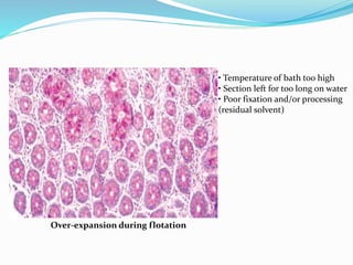 Over-expansion during flotation 
• Temperature of bath too high 
• Section left for too long on water 
• Poor fixation and/or processing 
(residual solvent) 
 