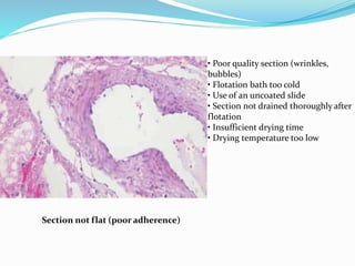 Section not flat (poor adherence) 
• Poor quality section (wrinkles, 
bubbles) 
• Flotation bath too cold 
• Use of an uncoated slide 
• Section not drained thoroughly after 
flotation 
• Insufficient drying time 
• Drying temperature too low 
 
