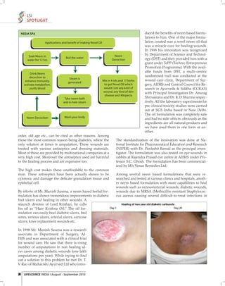 LSI
SPOTLIGHT
NEEM SPA
Applications and benefit of making Novel Oil

Soak Neem in
water for 12 hrs

Drink Neem
decoction to
enhance immunity,
activate metabolism,
purify blood

Steam is
generated

Neem
Decoction

Boil the water

Mix in 4 oils and 17 herbs
to get Novel Oil which
would cure any kind of
wound, any kind of skin
disease and Allopecia

Take neem bath
and in-hale steam

Neem Decoction

Wash your body

order, old age etc., can be cited as other reasons. Among
these the most common reason being diabetes, where the
only solution at times is amputation. These wounds are
treated with various antiseptics and dressing materials.
Most of these are provided by multinational companies at a
very high cost. Moreover the antiseptics used are harmful
to the healing process and are expensive too.
The high cost makes these unaffordable to the common
man. These antiseptics have been actually shown to be
cytotoxic and damage the delicate granulation tissue and
epithelial cell.
By efforts of Mr. Manish Saxena, a neem based herbal formulation has shown tremendous improvements in diabetic
foot ulcers and healing in other wounds. A
staunch devotee of Lord Krishan, he calls
his oil as “Hare Krishna Oil.” The oil formulation can easily heal diabetic ulcers, bed
sores, venous ulcers, arterial ulcers, varicose
ulcers, knee replacement wounds etc.
In 1998 Mr. Manish Saxena was a research
associate in Department of Surgery, AIIMS and was associated with a clinical trial
for wound care. He saw that there is rising
number of amputations in non healing ulcer cases among diabetic wounds (one lakh
amputations per year). While trying to ﬁ nd
out a solution to this problem he met Dr. T.
V Rao of Maharishi Ayurved Ltd who intro36 LIFESCIENCE INDIA | August - September 2013

duced the beneﬁts of neem based formulations to him. One of the major formulation created was a novel neem oil that
was a miracle cure for healing wounds.
In 1999 his innovation was recognized
by Department of Science and Technology (DST) and they provided him with a
grant under TePP (Techno-Entrepreneur
Promotion Programme). With the available funds from DST, a multi-centric
randomised trail was conducted at the
wound care clinic, Department of Surgery, AIIMS and Central Council for Research in Ayurveda & Siddha (CCRAS)
with Principal Investigators Dr. Anurag
Shrivastava and Dr. K.D Sharma respectively. All the laboratory experiments for
pre-clinical toxicity studies were carried
out at SGS India based in New Delhi.
The oil formulation was completely safe
and had no side-effects: obviously as the
ingredients are all natural products and
we have used them in one form or another.

The standardization of the innovation was done at National Institute for Pharmaceutical Education and Research
(NIPER) with Dr. Parikshit Bansal as the principal investigator. The formulation was also tested on eye wounds in
rabbits at Rajendra Prasad eye centre at AIIMS under Professor S.C. Ghosh. The formulation has been commercialized by M/s Venus Remedies Ltd.
Among several neem based formulations that were researched and tested at various clinics and hospitals, another neem based formulation with more capabilities to heal
wounds such as venous/arterial wounds, diabetic wounds,
wounds due to MRSA (Methicillin-resistant Staphylococcus aureus causing several difﬁcult-to-treat infections in

 