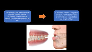 Los pacientes que presenten una
mordida cruzada anterior
incluyendo los 4 incisivos es
debido a un patrón esquelético de
CIII
Es prudente advertir a los padres
sobre un posible desfavorable
crecimiento y la necesidad de
una cirugía a futuro
 