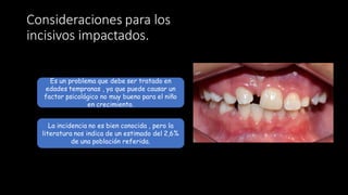 Consideraciones para los
incisivos impactados.
Es un problema que debe ser tratado en
edades tempranas , ya que puede causar un
factor psicológico no muy bueno para el niño
en crecimiento.
La incidencia no es bien conocida , pero la
literatura nos indica de un estimado del 2,6%
de una población referida.
 