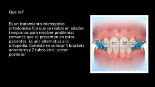 Que es?
Es un tratamiento interceptivo
ortodoncico fijo que se realiza en edades
tempranas para resolver problemas
comunes que se presentan en estos
pacientes. Es una alternativa a la
ortopedia. Consiste en colocar 4 brackets
anteriores y 2 tubos en el sector
posterior
 