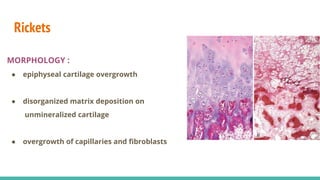 Vitamin D - sources, receptors, functions, deficiency, toxicity | PPTX