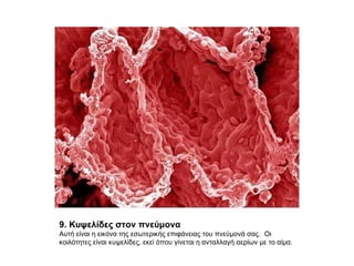 9. Κυψελίδες στον πνεύμονα  Αυτή είναι η εικόνα της εσωτερικής επιφάνειας του πνεύμονά σας.  Οι κοιλότητες είναι κυψελίδες, εκεί όπου γίνεται η ανταλλαγή αερίων με το αίμα.  
