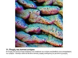 11. Πτυχές του λεπτού εντέρου  Οι πτυχές στο λεπτό έντερο αυξάνουν την επιφάνεια του εντέρου και βοηθούν στην απορρόφηση των τροφών.  Κοιτάξτε καλά και θα δείτε κάποιες τροφές κολλημένες σε μια από τις ρωγμές.  