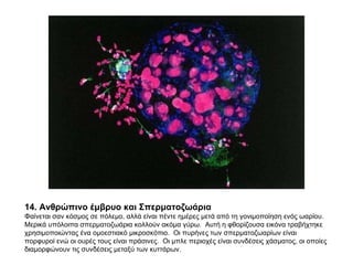 14. Ανθρώπινο έμβρυο και Σπερματοζωάρια Φαίνεται σαν κόσμος σε πόλεμο, αλλά είναι πέντε ημέρες μετά από τη γονιμοποίηση ενός ωαρίου.  Μερικά υπόλοιπα σπερματοζωάρια κολλούν ακόμα γύρω.  Αυτή η φθορίζουσα εικόνα τραβήχτηκε χρησιμοποιώντας ένα ομοεστιακό μικροσκόπιο.  Οι πυρήνες των σπερματοζωαρίων είναι πορφυροί ενώ οι ουρές τους είναι πράσινες.  Οι μπλε περιοχές είναι συνδέσεις χάσματος, οι οποίες διαμορφώνουν τις συνδέσεις μεταξύ των κυττάρων. 