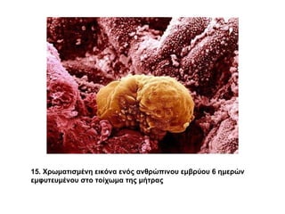 15. Χρωματισμένη εικόνα ενός ανθρώπινου εμβρύου 6 ημερών εμφυτευμένου στο τοίχωμα της μήτρας 