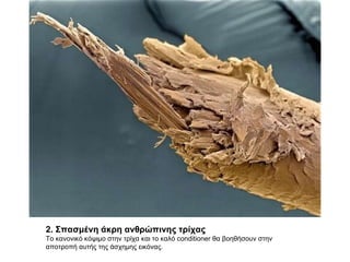 2. Σπασμένη άκρη ανθρώπινης τρίχας  Το κανονικό κόψιμο στην τρίχα και το καλό  conditioner  θα βοηθήσουν στην αποτροπή αυτής της άσχημης εικόνας. 