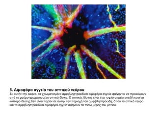 5. Αιμοφόρα αγγεία του οπτικού νεύρου  Σε αυτήν την εικόνα, τα χρωματισμένα αμφιβληστροειδικά αιμοφόρα αγγεία φαίνονται να προκύψουν από το μαύρο-χρωματισμένο οπτικό δίσκο. Ο οπτικός δίσκος είναι ένα τυφλό σημείο επειδή κανένα κύτταρο δέκτης δεν είναι παρόν σε αυτήν την περιοχή του αμφιβληστροειδή, όπου το οπτικό νεύρο και τα αμφιβληστροειδικά αιμοφόρα αγγεία αφήνουν το πίσω μέρος του ματιού.  