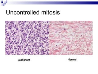 Uncontrolled mitosis 