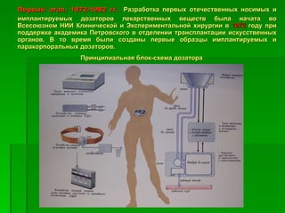 Первый этап. 1972-1982 гг.   Разработка первых отечественных носимых и имплантируемых дозаторов лекарственных веществ была начата во Всесоюзном НИИ Клинической и Экспериментальной хирургии в  1972  году при поддержке академика Петровского в отделении трансплантации искусственных органов. В то время были созданы первые образцы имплантируемых и паракорпоральных дозаторов. Принципиальная блок-схема дозатора 