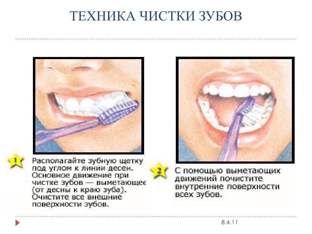 Уровень гигиены полости рта. Гигиена полости рта. Гигиена полости рта рисунок. Уход за полостью рта рисунок.