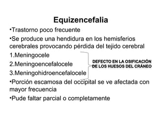 Equizencefalia
•Trastorno poco frecuente
•Se produce una hendidura en los hemisferios
cerebrales provocando pérdida del tejido cerebral
1.Meningocele
2.Meningoencefalocele
3.Meningohidroencefalocele
•Porción escamosa del occipital se ve afectada con
mayor frecuencia
•Pude faltar parcial o completamente
 