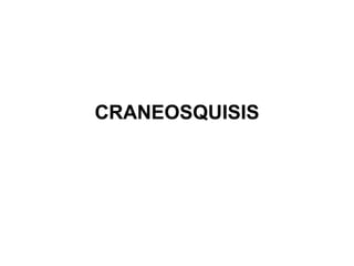 CRANEOSQUISIS
 