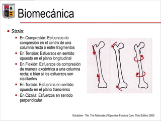 Biomecánica
 Strain:
 En Compresión: Esfuerzos de
compresión en el centro de una
columna recta o entre fragmentos
 En Tensión: Esfuerzos en sentido
opuesto en el plano longitudinal
 En Flexión: Esfuerzos de compresión
de manera excéntrica a una columna
recta; o bien si los esfuerzos son
cizallantes
 En Torsión: Esfuerzos en sentido
opuesto en el plano transverso
 En Cizalla: Esfuerzos en sentido
perpendicular
Schatzker · Tile. The Rationale of Operative Fracture Care. Third Edition 2005
 