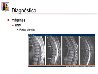 Diagnóstico
 Imágenes
 RNM
 Partes blandas
 