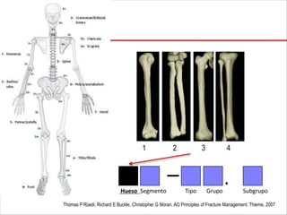 Thomas P Rüedi, Richard E Buckle, Christopher G Moran. AO Principles of Fracture Management. Thieme. 2007
1 2 3 4
— .
Hueso Segmento Tipo Grupo Subgrupo
 