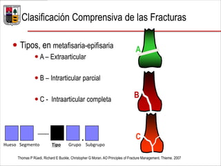  Tipos, en metafisaria-epifisaria
 A – Extraarticular
 B – Intrarticular parcial
 C - Intraarticular completa
Thomas P Rüedi, Richard E Buckle, Christopher G Moran. AO Principles of Fracture Management. Thieme. 2007
Clasificación Comprensiva de las Fracturas
A
B
C— .Hueso Segmento Tipo Grupo Subgrupo
 