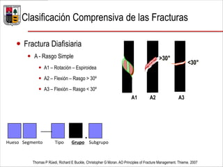  Fractura Diafisiaria
 A - Rasgo Simple
 A1 – Rotación – Espiroidea
 A2 – Flexión – Rasgo > 30º
 A3 – Flexión – Rasgo < 30º
Thomas P Rüedi, Richard E Buckle, Christopher G Moran. AO Principles of Fracture Management. Thieme. 2007
Clasificación Comprensiva de las Fracturas
A1 A2 A3
>30°
<30°
— .Hueso Segmento Tipo Grupo Subgrupo
 