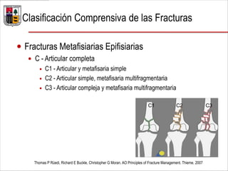  Fracturas Metafisiarias Epifisiarias
 C - Articular completa
 C1 - Articular y metafisaria simple
 C2 - Articular simple, metafisaria multifragmentaria
 C3 - Articular compleja y metafisaria multifragmentaria
Thomas P Rüedi, Richard E Buckle, Christopher G Moran. AO Principles of Fracture Management. Thieme. 2007
C1 C2 C3
Clasificación Comprensiva de las Fracturas
 