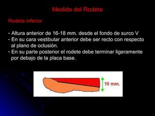 Prueba de rodetes y registros en protesis total | PPT