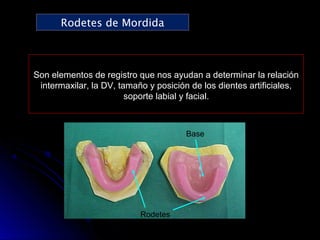 Prueba de rodetes y registros en protesis total | PPT