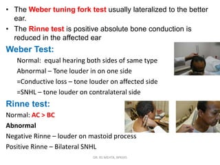 5. menier's disease | PPSX