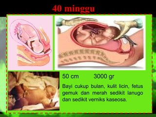 40 minggu

50 cm

3000 gr

Bayi cukup bulan, kulit licin, fetus
gemuk dan merah sedikit lanugo
dan sedikit verniks kaseosa.

 