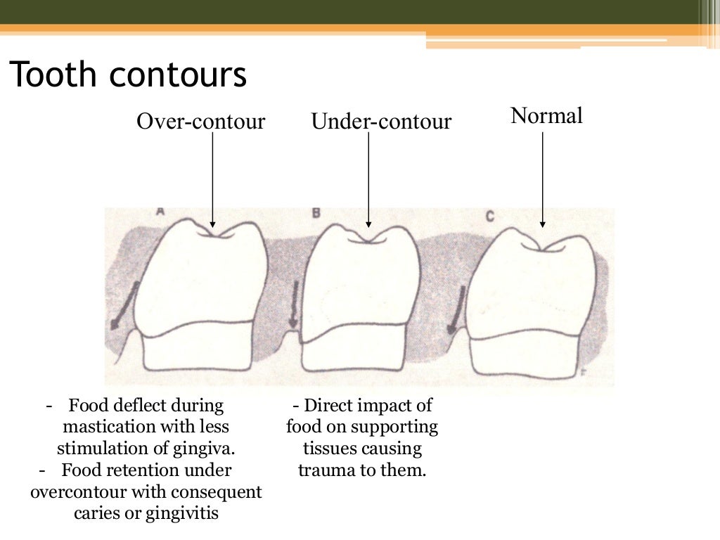 tooth form and occlusion