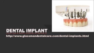5. dental implants (d)