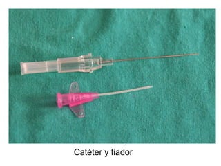 Catéter y fiador