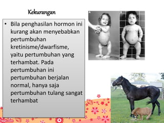 Kekurangan
• Bila penghasilan hormon ini
kurang akan menyebabkan
pertumbuhan
kretinisme/dwarfisme,
yaitu pertumbuhan yang
terhambat. Pada
pertumbuhan ini
pertumbuhan berjalan
normal, hanya saja
pertumbuhan tulang sangat
terhambat
 
