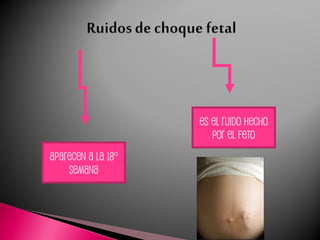 Aparecen a la 18°
semana
Es el ruido hecho
por el feto
 