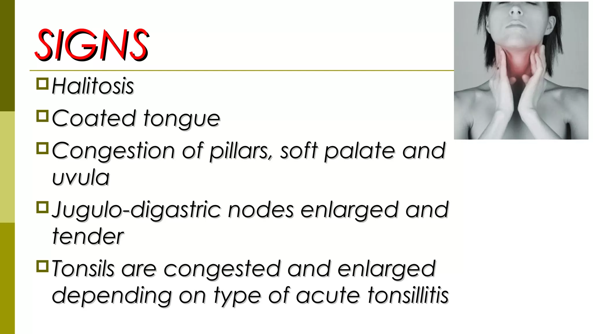SIGNSSIGNS
HalitosisHalitosis
Coated tongueCoated tongue
Congestion of pillars, soft palate andCongestion of pillars, soft palate and
uvulauvula
Jugulo-digastric nodes enlarged andJugulo-digastric nodes enlarged and
tendertender
Tonsils are congested and enlargedTonsils are congested and enlarged
depending on type of acute tonsillitisdepending on type of acute tonsillitis
 