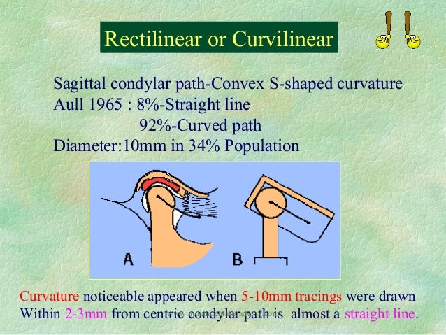 Straight Line Articulator : Articulators fixed orthodontic courses