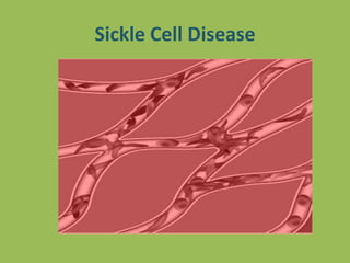 Sickle Cell Disease
 