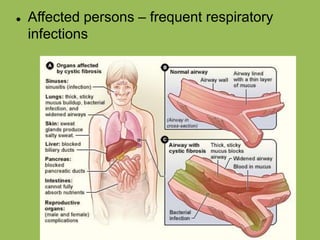  Affected persons – frequent respiratory
infections
 
