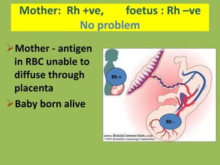 Mother: Rh +ve, foetus : Rh –ve
No problem
Mother - antigen
in RBC unable to
diffuse through
placenta
Baby born alive
Rh +
Rh -
 